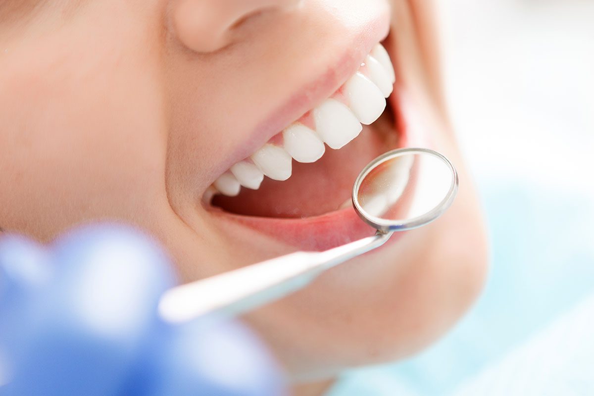dental bonding cosmetic dentist Manhattan Beach