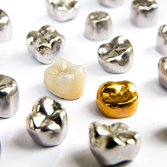 redondo beach cosmetic dentist near me dental crowns
