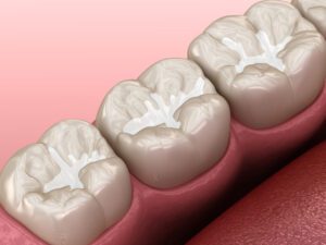 prevent cavities for children